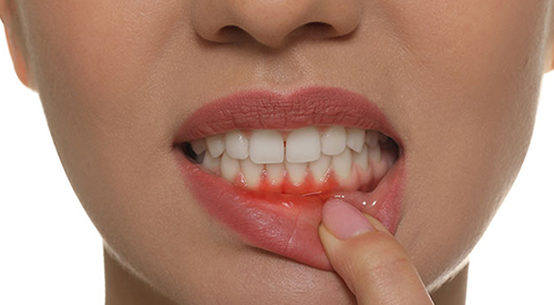Periodontics