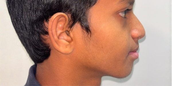 Case 4 after