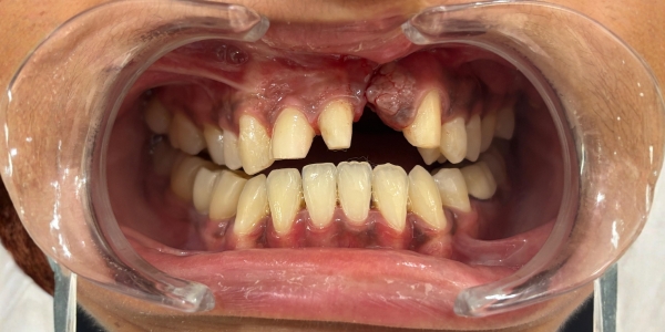 Case1 before